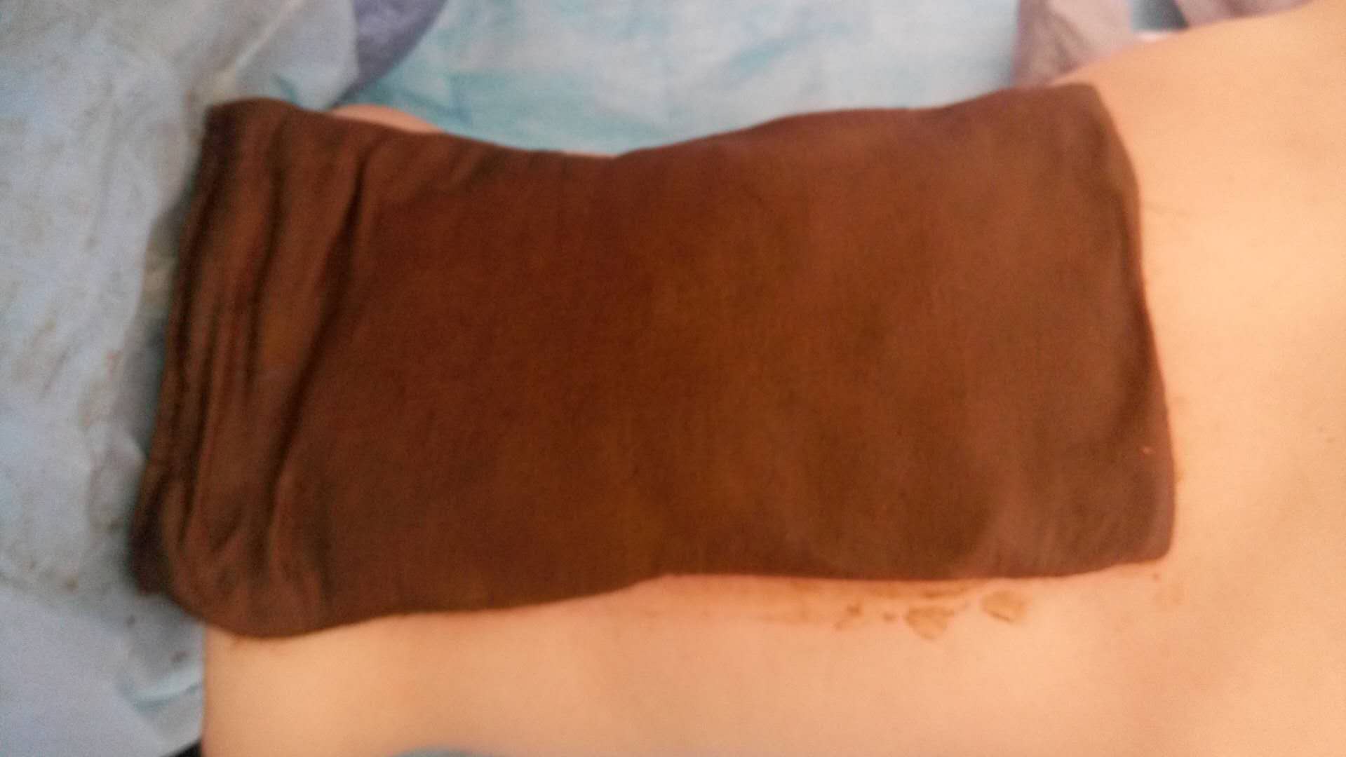 滑膜炎/蘭州玉善堂