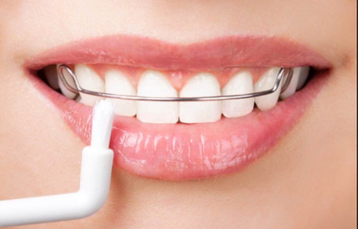 膠南牙齒冷光美白電話/黃島沈氏口腔